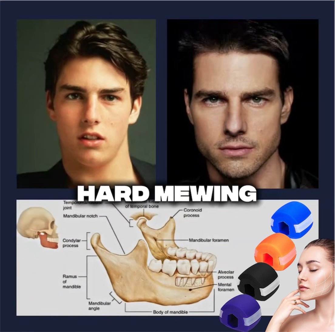 Jawflex™ - Jaw, Face, and Neck Exerciser - Revvora